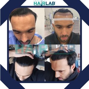 istanbulhairlab_264480624_424106102690390_6790708472503439903_n-unsmushed